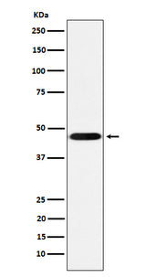 Anti-CD16 Rabbit Monoclonal Antibody Boster Bio