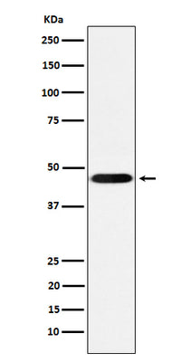 Anti-CD16 Rabbit Monoclonal Antibody Boster Bio