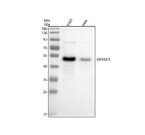 Anti-GATA2/3 Rabbit Monoclonal Antibody Boster Bio