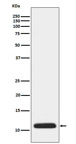 Anti-APOC3 Rabbit Monoclonal Antibody Boster Bio