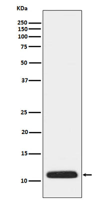 Anti-APOC3 Rabbit Monoclonal Antibody Boster Bio
