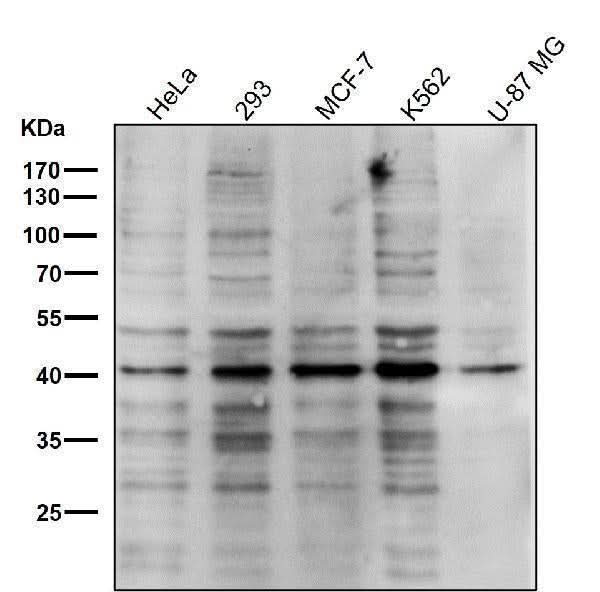 Anti-PRMT1 Rabbit Monoclonal Antibody Boster Bio