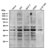 Anti-PRMT1 Rabbit Monoclonal Antibody Boster Bio