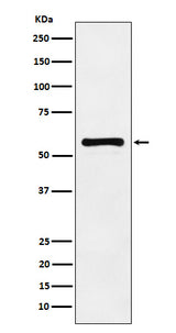 Anti-PAK2 Monoclonal Antibody Boster Bio