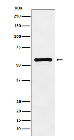 Anti-PAK2 Monoclonal Antibody Boster Bio