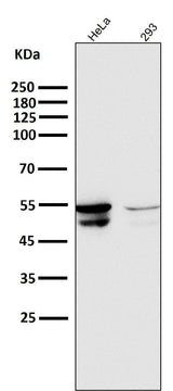 Anti-Cytokeratin 8 KRT8 Rabbit Monoclonal Antibody Boster Bio