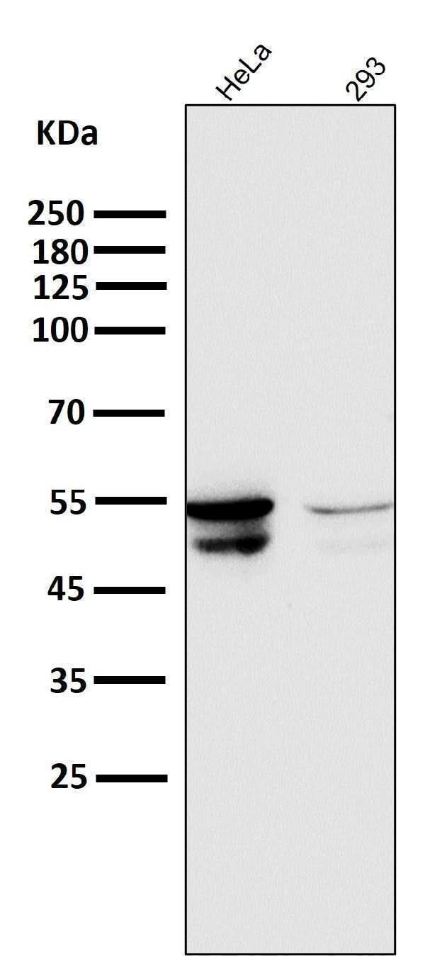 Anti-Cytokeratin 8 KRT8 Rabbit Monoclonal Antibody Boster Bio