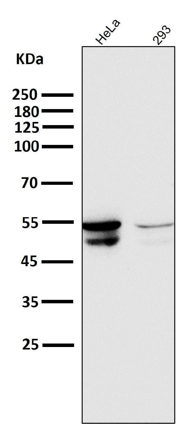 Anti-Cytokeratin 8 KRT8 Rabbit Monoclonal Antibody Boster Bio