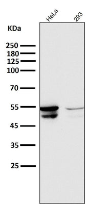 Anti-Cytokeratin 8 KRT8 Rabbit Monoclonal Antibody Boster Bio