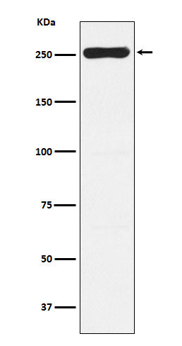Anti-WNK1 Rabbit Monoclonal Antibody Boster Bio