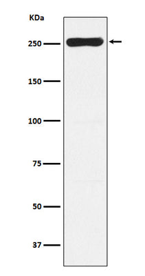 Anti-WNK1 Rabbit Monoclonal Antibody Boster Bio