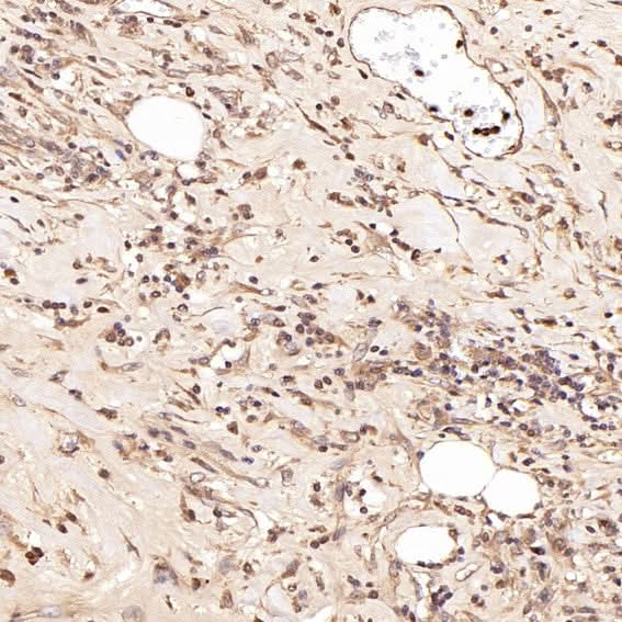 Anti-Smad5 Rabbit Monoclonal Antibody Boster Bio