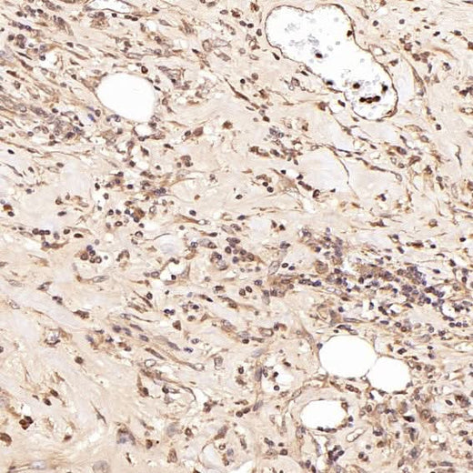 Anti-Smad5 Rabbit Monoclonal Antibody Boster Bio