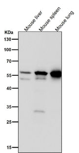 Anti-Lyn Rabbit Monoclonal Antibody Boster Bio