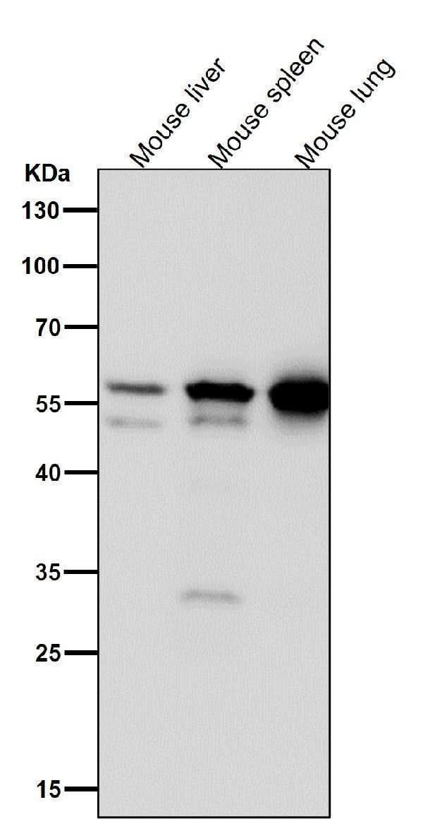 Anti-Lyn Rabbit Monoclonal Antibody Boster Bio