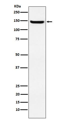 Anti-JAG2 Rabbit Monoclonal Antibody Boster Bio
