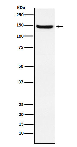 Anti-JAG2 Rabbit Monoclonal Antibody Boster Bio