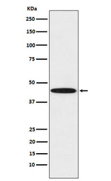 Anti-DDB2 Rabbit Monoclonal Antibody Boster Bio
