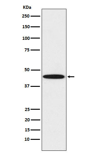 Anti-DDB2 Rabbit Monoclonal Antibody Boster Bio