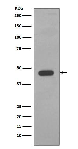 Anti-Cytokeratin 14 KRT14 Rabbit Monoclonal Antibody Boster Bio
