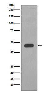 Anti-Cytokeratin 14 KRT14 Rabbit Monoclonal Antibody Boster Bio