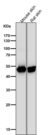 Anti-Cytokeratin 14 KRT14 Rabbit Monoclonal Antibody Boster Bio