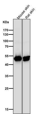 Anti-Cytokeratin 14 KRT14 Rabbit Monoclonal Antibody Boster Bio
