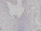 Anti-Rab11A Antibody Picoband® (monoclonal, 4H9 Boster Bio