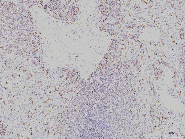 Anti-Rab11A Antibody Picoband® (monoclonal, 4H9 Boster Bio