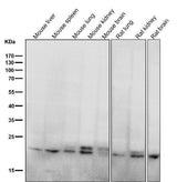 Anti-RAB11A Rabbit Monoclonal Antibody Boster Bio