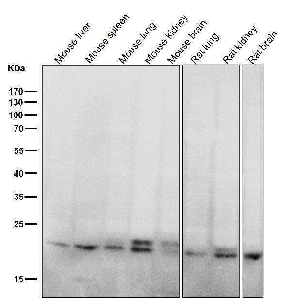 Anti-RAB11A Rabbit Monoclonal Antibody Boster Bio