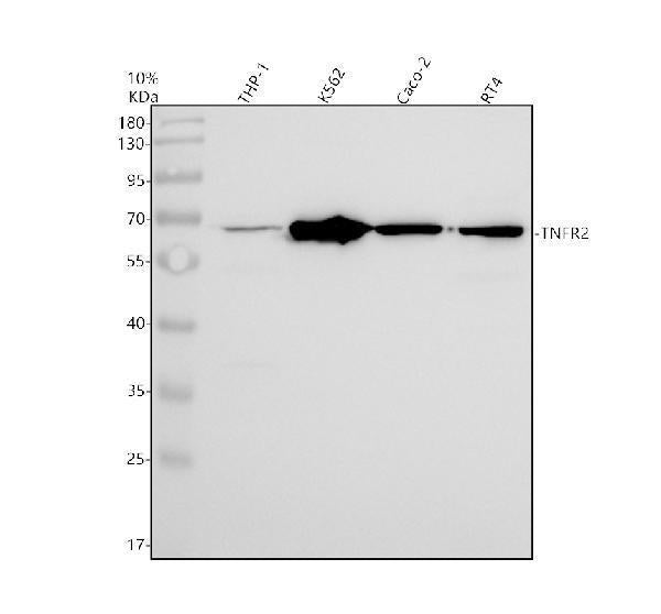 Anti-TNF Receptor II TNFRSF1B Rabbit Monoclonal Antibody Boster Bio