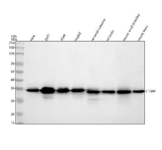 Anti-C1QBP Rabbit Monoclonal Antibody Boster Bio