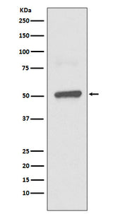 Anti-BPI Rabbit Monoclonal Antibody Boster Bio
