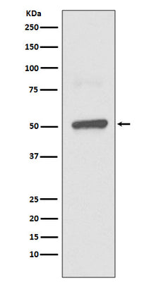 Anti-BPI Rabbit Monoclonal Antibody Boster Bio