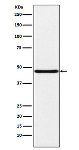 Anti-NPHS2 Rabbit Monoclonal Antibody Boster Bio