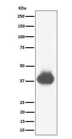 Anti-CD32A + CD32B + CD32C Rabbit Monoclonal Antibody Boster Bio