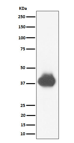 Anti-CD32A + CD32B + CD32C Rabbit Monoclonal Antibody Boster Bio