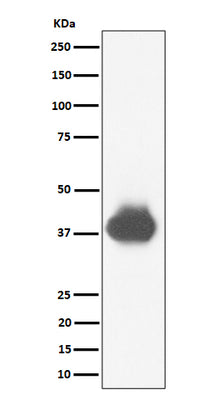 Anti-CD32A + CD32B + CD32C Rabbit Monoclonal Antibody Boster Bio