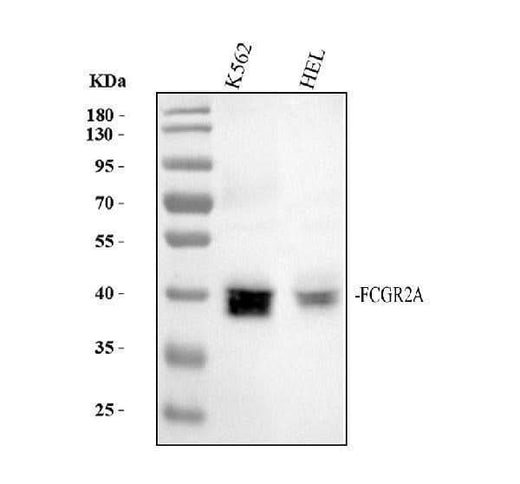 Anti-CD32 FCGR2A Rabbit Monoclonal Antibody Boster Bio