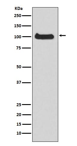 Anti-PKC mu Rabbit Monoclonal Antibody Boster Bio