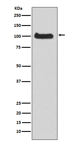Anti-PKC mu Rabbit Monoclonal Antibody Boster Bio