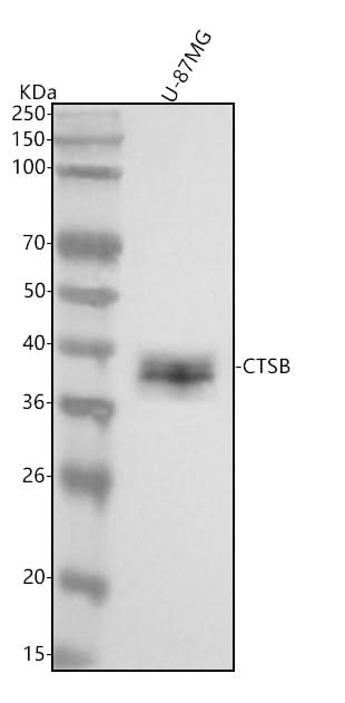 Anti-Cathepsin B CTSB Rabbit Monoclonal Antibody Boster Bio