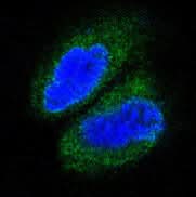 Anti-MAP3K7 Monoclonal Antibody Boster Bio