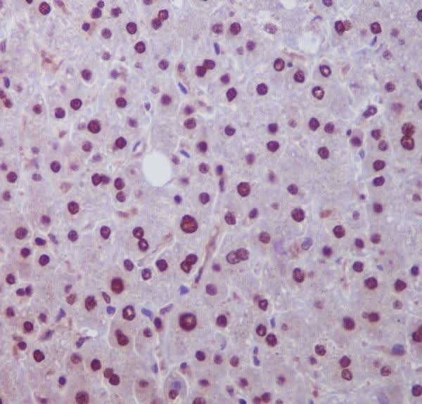 Anti-Hes1 Rabbit Monoclonal Antibody Boster Bio