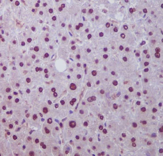 Anti-Hes1 Rabbit Monoclonal Antibody Boster Bio