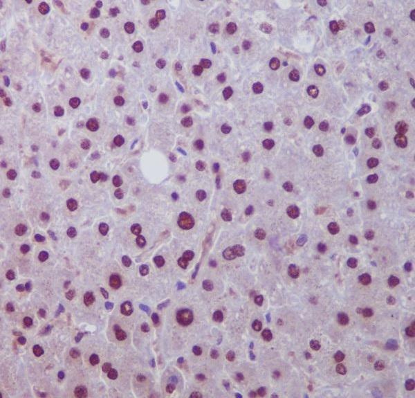 Anti-Hes1 Rabbit Monoclonal Antibody Boster Bio