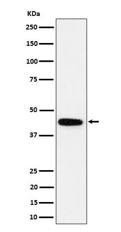 Anti-GALT Rabbit Monoclonal Antibody Boster Bio