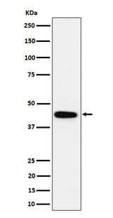 Anti-GALT Rabbit Monoclonal Antibody Boster Bio