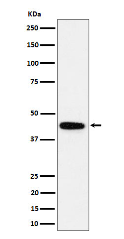 Anti-GALT Rabbit Monoclonal Antibody Boster Bio